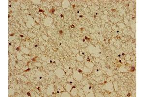 Immunohistochemistry of paraffin-embedded human brain tissue using ABIN7146577 at dilution of 1:100 (DREAM 抗体  (AA 1-145))