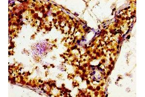 Immunohistochemistry (IHC) image for anti-Solute Carrier Family 16, Member 12 (Monocarboxylic Acid Transporter 12) (SLC16A12) (AA 431-486) antibody (ABIN7160161)