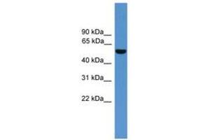 Image no. 1 for anti-Aldehyde Dehydrogenase 9 Family, Member A1 (ALDH9A1) (AA 351-400) antibody (ABIN6746619) (ALDH9A1 抗体  (AA 351-400))
