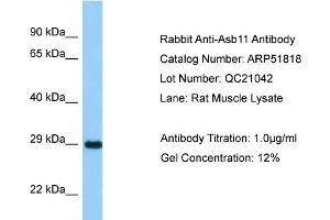 Western Blotting (WB) image for anti-Ankyrin Repeat and SOCS Box-Containing 11 (ASB11) (N-Term) antibody (ABIN2784641) (ASB11 抗体  (N-Term))