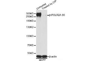 Western blot analysis of extracts of MCF7 cells using Phospho-POLR2A(S5) Polyclonal Antibody at dilution of 1:1000. (POLR2A/RPB1 抗体  (pSer5))