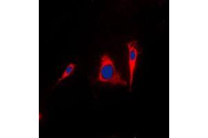 Immunofluorescent analysis of 14-3-3 gamma staining in A431 cells. (14-3-3 gamma 抗体  (Center))