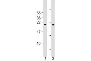 Western blot testing of human 1) cerebellum and 2) spleen tissue lysate with Grancalcin antibody at 1:2000. (Grancalcin 抗体  (AA 19-53))