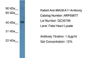 WB Suggested Anti-MAGEA11  Antibody Titration: 0. (MAGEA11 抗体  (Middle Region))