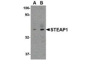 Western Blotting (WB) image for anti-Six Transmembrane Epithelial Antigen of The Prostate 1 (STEAP1) (C-Term) antibody (ABIN2476601) (STEAP1 抗体  (C-Term))