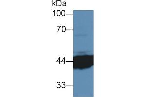 Detection of IL3Ra in Human MCF7 cell lysate using Polyclonal Antibody to Interleukin 3 Receptor Alpha (IL3Ra) (IL3RA 抗体  (AA 167-331))