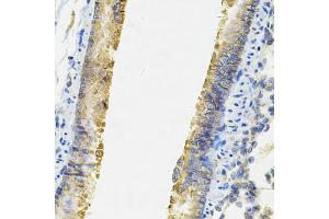 Immunohistochemistry of paraffin-embedded rat lung using ACSS2 Antibody (ABIN6292756) at dilution of 1:100 (40x lens). (ACSS2 抗体)