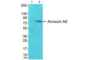 Western blot analysis of extracts from HepG2 cells using Annexin A6 antibody. (ANXA6 抗体)