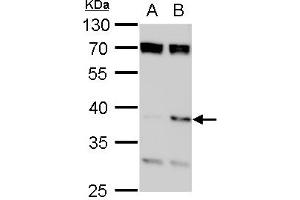 WB Image SET antibody, isoform 2-specifc detects SET protein by western blot analysis. (SET/TAF-I 抗体  (N-Term))