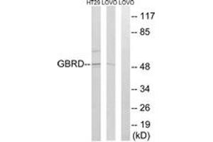 Western blot analysis of extracts from LOVO/HT-29 cells, using GABRD Antibody. (GABRD 抗体  (AA 141-190))