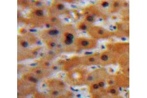 Used in DAB staining on fromalin fixed paraffin-embedded Liver tissue (GCP2 抗体  (AA 40-114))