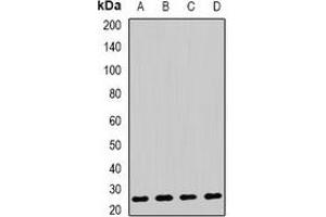 Western blot analysis of AK4 expression in HepG2 (A), Raji (B), mouse liver (C), mouse kidney (D) whole cell lysates. (AK4 抗体)