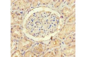 Immunohistochemistry of paraffin-embedded human kidney tissue using ABIN7174258 at dilution of 1:100 (USP14 抗体  (C-Term))