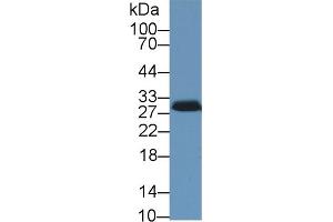 Western Blotting (WB) image for anti-Steroidogenic Acute Regulatory Protein (STAR) (AA 1-285) antibody (ABIN7441349)