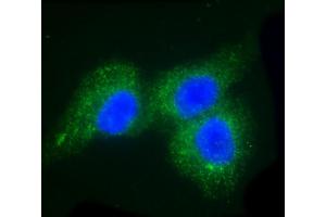 Immunofluorescent analysis of 4 % paraformaldehyde-fixed, 0. (F13A1 抗体  (AA 60-94))