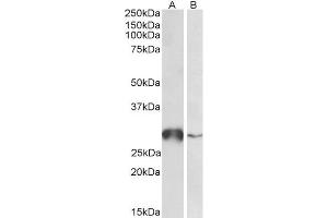 ABIN5539847 (0. (GSTO1 抗体  (Internal Region))