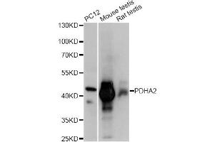 Western blot analysis of extracts of various cell lines, using PDHA2 antibody (ABIN6293729) at 1:1000 dilution. (PDHA2 抗体)