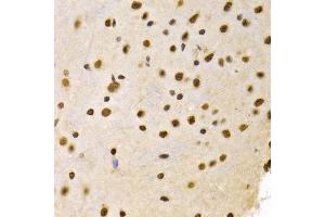 Immunohistochemistry of paraffin-embedded mouse brain using DNMT3A Antibody (ABIN1872325) at dilution of 1:100 (40x lens). (DNMT3A 抗体)