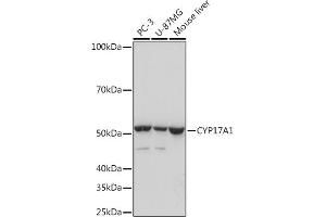 Western blot analysis of extracts of various cell lines, using CYP17 Rabbit mAb (ABIN7266648) at 1:1000 dilution. (CYP17A1 抗体)
