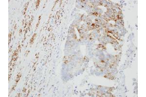 Immunohistochemistry (IHC) image for anti-Monoamine Oxidase B (MAOB) antibody (ABIN2856231)