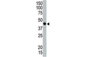 Western blot testing of TSG101 antibody and ZR75-1 cell lysate. (TSG101 抗体  (AA 340-370))