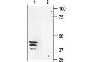 Western blot analysis of rat kidney membranes: - 1.