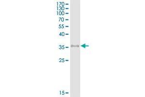 Image no. 1 for Epithelial Cell Adhesion Molecule (EPCAM) (AA 24-265) protein (His-DYKDDDDK-Strep II Tag) (ABIN2752784)