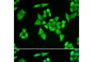 Immunofluorescence analysis of HeLa cells using ADSL Polyclonal Antibody (Adenylosuccinate Lyase 抗体)
