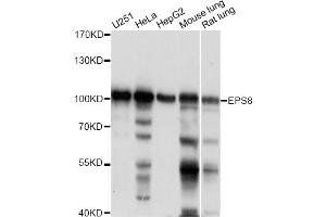 Western blot analysis of extracts of various cell lines, using EPS8 antibody. (EPS8 抗体)