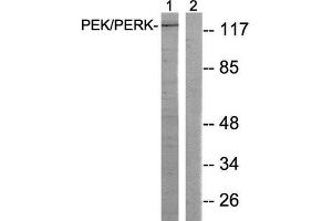 Western Blotting (WB) image for anti-Eukaryotic Translation Initiation Factor 2-alpha Kinase 3 (EIF2AK3) (Thr981) antibody (ABIN1848259) (PERK 抗体  (Thr981))