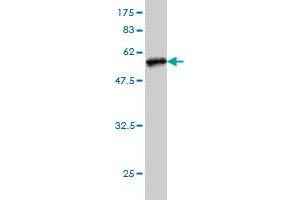 Western Blot detection against Immunogen (49. (TREM1 抗体  (AA 21-234))