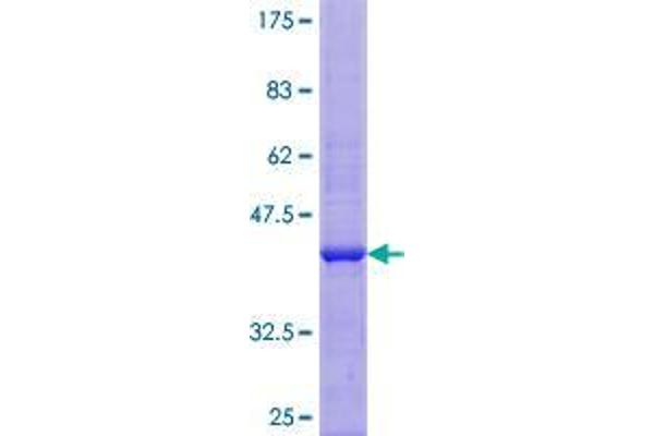 ZNF160 Protein (AA 1-147) (GST tag)