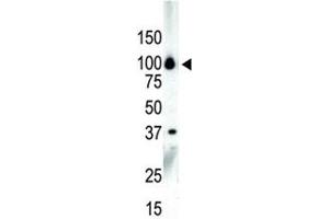 Western blot analysis of PKC nu antibody and NCI-H460 cell lysate (PRKD3 抗体  (AA 860-890))