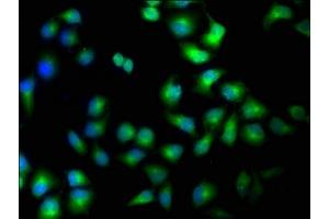 Immunofluorescence staining of Hela cells with ABIN7169187 at 1:100, counter-stained with DAPI. (TAO Kinase 1 (TAOK1) (AA 400-659) 抗体)