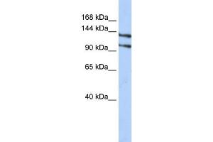 WB Suggested Anti-RBM5 Antibody Titration:  0. (RBM5 抗体  (N-Term))