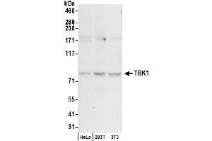 Western Blotting (WB) image for anti-TANK-Binding Kinase 1 (TBK1) (C-Term) antibody (ABIN7450810)
