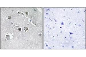 Immunohistochemistry analysis of paraffin-embedded human brain tissue, using Collagen XI alpha2 Antibody. (COL11A2 抗体  (AA 1211-1260))
