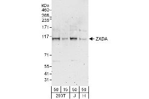 anti-Zinc Finger, X-Linked, Duplicated A (ZXDA) (AA 1-50) antibody