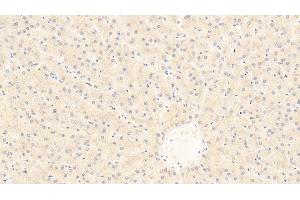 Immunohistochemistry (IHC) image for anti-Interleukin 1 Receptor-Like 1 (IL1RL1) (AA 162-349) antibody (ABIN7437368)