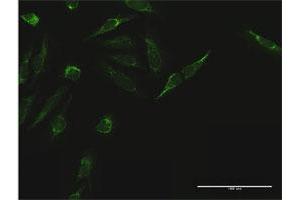 Immunofluorescence of purified MaxPab antibody to TIMM44 on HeLa cell. (TIMM44 抗体  (AA 1-452))