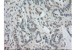 Image no. 1 for anti-Budding Uninhibited By Benzimidazoles 1 Homolog beta (Yeast) (BUB1B) antibody (ABIN1497000) (BUB1B 抗体)