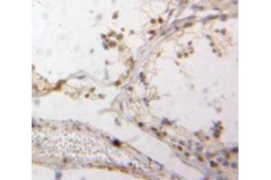 Used in DAB staining on fromalin fixed paraffin-embedded Testis tissue (DR1 抗体  (AA 2-170))