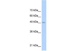 TLR6 antibody used at 1 ug/ml to detect target protein. (TLR6 抗体  (Middle Region))