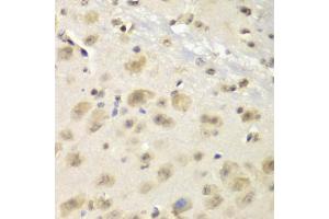 Immunohistochemistry of paraffin-embedded mouse brain using S100A10 antibody (ABIN5971035) at dilution of 1/100 (40x lens). (S100A10 抗体)