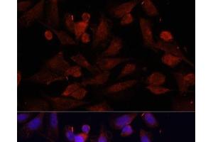 Immunofluorescence analysis of U2OS cells using GPER1 Polyclonal Antibody at dilution of 1:100. (Mesothelin 抗体)