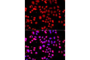 Immunofluorescence analysis of A549 cells using ASPSCR1 antibody (ABIN5975297). (ASPSCR1 抗体)