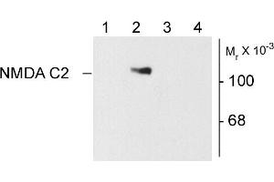 Western blots of 10 ug of HEK 293 cells showing specific immunolabeling of the ~120k NR1 subunit of the NMDA receptor containing the C2 splice variant insert.