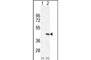 Western blot analysis of PRKAG1 (arrow) using rabbit polyclonal PRKAG1 Antibody (N-term) (ABIN655798 and ABIN2845227). (PRKAG1 抗体  (N-Term))