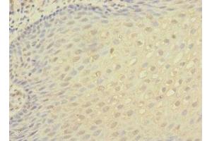 Immunohistochemistry (IHC) image for anti-Integrin, alpha X (Complement Component 3 Receptor 4 Subunit) (ITGAX) (AA 100-350) antibody (ABIN7156472)