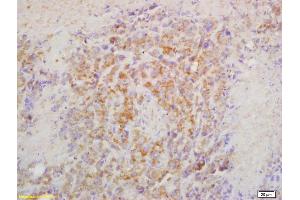 Formalin-fixed and paraffin embedded mouse lymphoma labeled with Rabbit Anti CRTAM Polyclonal Antibody, Unconjugated (ABIN1387894) at 1:200 followed by conjugation to the secondary antibody and DAB staining (CRTAM 抗体  (AA 31-130))